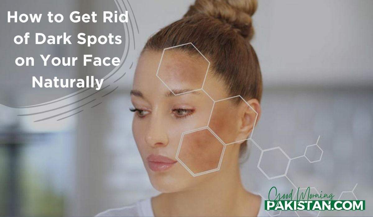 Dark Spots on Your Face